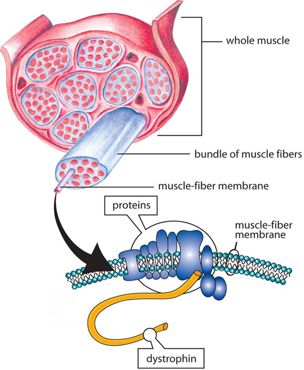 Muscles are made up of bundles of fibers (cells). A group of interdependent proteins along the membrane surrounding each fiber helps to keep muscle cells working properly. When one of these proteins, dystrophin, is absent, the result is DMD; poor or inadequate dystrophin results in BMD.