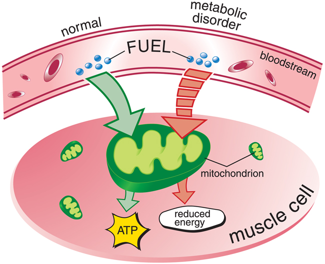 In normal metabolism, food provides fuel that's processed inside the cells, producing energy (ATP) for muscle contraction and other cellular functions. In metabolic myopathies, missing enzymes prevent mitochondria from properly processing fuel, and no energy is produced for muscle function.