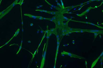 Emanuela Gussoni (DMD/BMD): Immature muscle fibers called myotubes (green) and their nuclei (blue) developed from MCAM-producing cells extracted from human muscle and cultured in the laboratory. Cells with the MCAM protein on the surface may be good candidates for cell transplantation to treat muscular dystrophies.