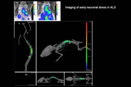 Jasna Kriz (ALS): This photo of a living “SOD1 mutant reporter mouse” illustrates a 3-dimensional representation of early neuronal stress. Such assessments can be made over a period of time and in a noninvasive manner.