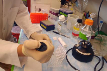 David Lynch (FA): Lynch's research team will use a process called frataxin dipstick testing in its studies to determine the relationship between abnormal resistance of the hormone insulin and Friedreich's ataxia.