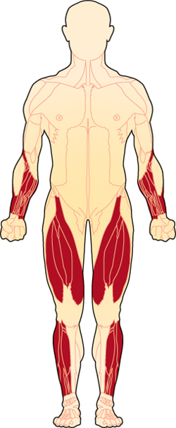 The first muscles affected in inclusion body myositis are usually those of the wrists and fingers, and the muscles at the front of the thigh. The muscles that lift the front of the foot also may be affected.