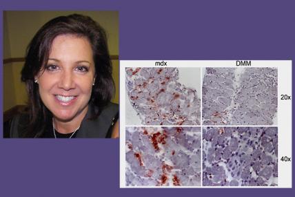 Melissa Spencer (DMD/BMD): Pictured is a section (left) of a diaphragm muscle taken from a dystrophin-deficient mouse (top, lower magnification; bottom, higher magnification). Immune system cells are stained red. On the right is a section of a diaphragm muscle taken from a dystrophin-deficient, osteopontin-deficient mouse. There are almost no immune system cells in this sample.