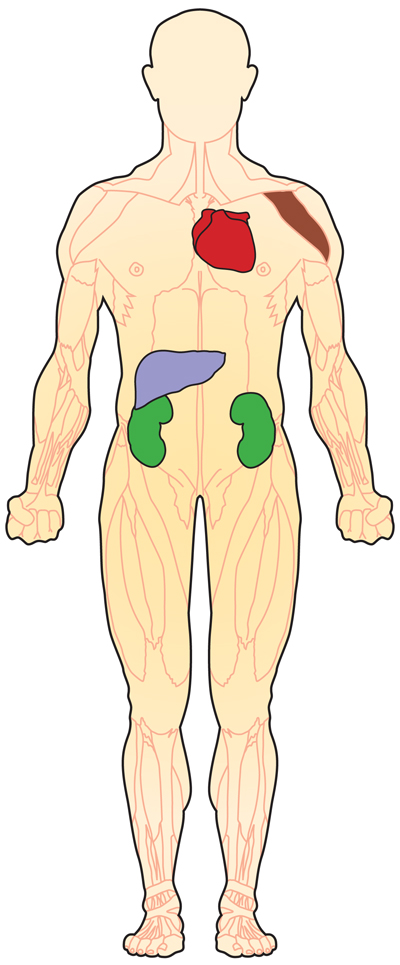 Muscles and organs affected in metabolic diseases