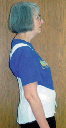 Woman wearing a corset-style back support