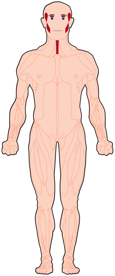 muscles affected in OPMD