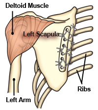 Illustration of the deltoid and left scapula