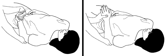 Illustration of an exercise for the elbow