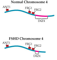 On an FSHD chromosome, the DNA sequence is repeated fewer than 11 times.