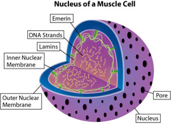 EDMD can be caused by abnormalities of one of the lamins or of emerin, located in or near the inner membrane of the nuclear envelope. Lamin abnormalities, and possibly emerin abnormalities, can trigger abnormal activation of a heart-damaging pathway.