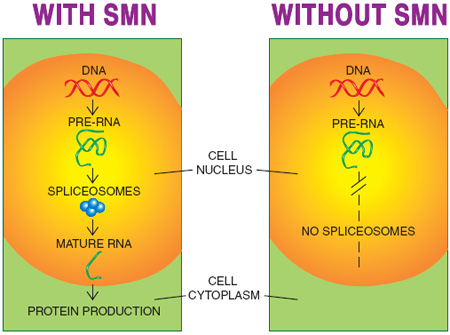 One function of SMN that’s widely acknowledged is its role in forming spliceosomes, molecular workbenches where rough-draft RNA is spliced into the final, or “messenger,” RNA, from which protein molecules are made. Synthesis of several proteins is probably adversely affected by SMN deficiency.