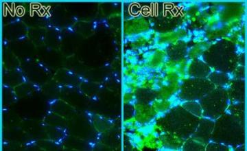Harol Bernstein (DMD/BMD): (Left) A section of mouse leg muscle shows normal muscle fibers, with muscle cell nuclei shown in blue and aligned properly at the edge of muscle fibers. (Right) A similar mouse leg muscle in which human embryonic stem cells, distinguished by green fluorescence and centralized nuclei, have been injected.