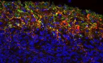 François Berthod (ALS): This image shows mouse nervous system cells cultured in a three-dimensional environment. Motor neurons (red) and Schwann cells (green) are positioned at the top of the model, or what would be considered the "spinal cord compartment." The long axons extending from these cells can be seen migrating down through the bottom part of the model, which mimics connective tissue. Cell nuclei are stained blue.