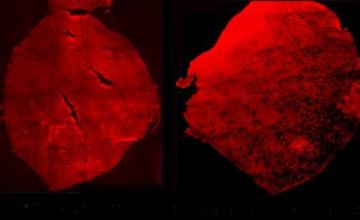 Carmen Bertoni (DMD/BMD): Under the microscope: Cross sections of muscle analyzed for dystrophin, the protein missing but needed in Duchenne muscular dystrophy. Pictured at left is the untreated control; at right, muscle two weeks after injection to correct the dystrophin defect.