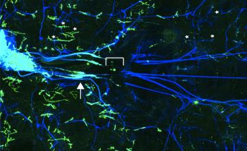 The peripheral nervous system of the fruit fly Drosophila melanogaster, shown with synaptic vesicle proteins in green and nerve membranes in blue. The green structure at far left is the ventral nerve cord where motor neuron cell bodies reside. The bracket shows the site of crush injury to these nerves. The arrow shows accumulation of synaptic protein proximal to the injury.  Asterisks mark select neuromuscular junctions (NMJs).