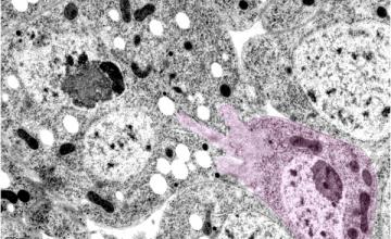 Elizabeth Chen (Muscle Physiology): Image of an immature muscle cell called a myoblast (pseudo-colored in pink) invades a myotube (an aggregation of myoblasts) to initiate myoblast fusion during fruit fly muscle development.