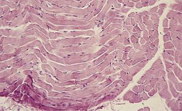 Ju Chen (MMD): Voluntary (skeletal) muscle at 100 times magnification.