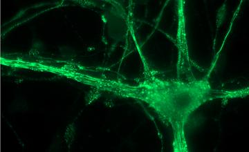 In this image of a motor neuron, the bright dots are clumps containing mutant FUS protein.
