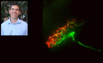 Darin Falk (Pompe): next to an image of mouse neuromuscular junction