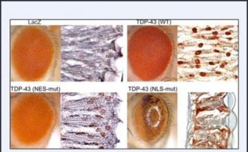 Steven Greenberg (IBM): Mislocalization of TDP43 protein causes degeneration in the eyes of 1-day-old fruit flies. Greenberg, and co-principal investigator J. Paul Taylor, will examine the effects of similar TDP43 redistribution in inclusion-body myositis, with a particular focus on whether it causes damage to muscle fibers.