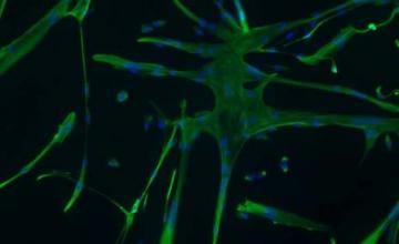 Emanuela Gussoni (DMD/BMD): Immature muscle fibers called myotubes (green) and their nuclei (blue) developed from MCAM-producing cells extracted from human muscle and cultured in the laboratory. Cells with the MCAM protein on the surface may be good candidates for cell transplantation to treat muscular dystrophies.