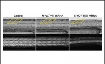 Michael Hauser (LGMD): Pictured Zebrafish model injected with (left) nothing, (middle) human myotilin gene (MYOT) and (right) the myotilin gene containing the T571 mutation that causes LGMD1A. (Photo credit: Erica Davis, Ph.D.)