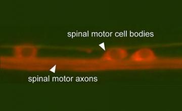 Oliver Hobert (ALS) : Nerve cells called motor neurons in the spinal cord of the nematode (roundworm) C. elegans are labeled with red fluorescent protein (RFP). Hobert's team will assess whether and how the TDP43 gene, known to cause some forms of ALS, affects these cells.