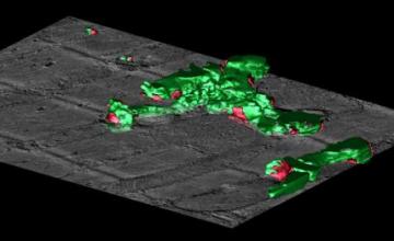 Masahiko Hoshijima (DMD/BMD): An imaging technique called high-resolution Electron Microscope (EM) Tomography provides a 3D rendering of structural heart-muscle cell abnormalities characteristic in BIO14.6 hamsters.