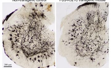 Eric Huang (ALS): Left: Staining in the spinal cord of a normal (control) mouse model shows elaborate motor neuron structure. Right: In contrast, the structure of motor neurons in a transgenic mouse carrying mutated FUS genes are significantly less complex.
