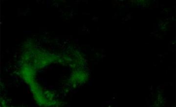 Adrian Israelson (ALS): Studies have shown, in spinal cords from the SOD1G37R research mouse model, that there is little accumulation of misfolded SOD1 at disease onset, but that it preferentially locates within motor neurons.
