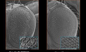 Albena Jordanova (CMT): Images taken with a scanning electron microscope show (left) the eye of a fruit fly carrying the human YARS protein containing a specific mutation that causes dominant intermediate Charcot-Marie-Tooth type C (DI-CMTC) neuropathy in humans, and (right) a normal fruit fly eye.