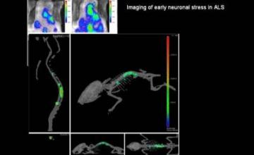 Jasna Kriz (ALS): This photo of a living “SOD1 mutant reporter mouse” illustrates a 3-dimensional representation of early neuronal stress. Such assessments can be made over a period of time and in a noninvasive manner.