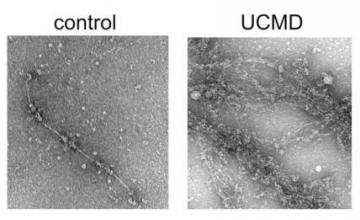 Shireen Lamande (CMD): (Left) image of a collagen 6 microfibril; (Right) unusual collagen 6 aggregates secreted by fibroblasts from a CMD patient who does not have a collagen 6 mutation. The mutation in this patient, Lamande says, might be in the gene for a protein that interacts with collagen 6.