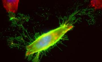 Jocelyn Laporte (CNM/MTM): Pictured a localization of myotubularin (green), the first protein to be implicated in centronuclear myopathy, in cultured cells.
