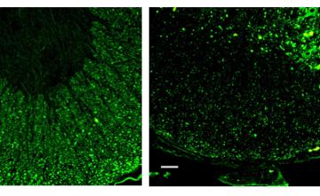 Spinal cords from unaffected mice (left), and mice with a mutation in the NFL gene (right) are stained with anti-NFL antibody and reveal extensive formation of neurofilamentous inclusions in the mutant mice. (Scale bar = 50 micrometers.)