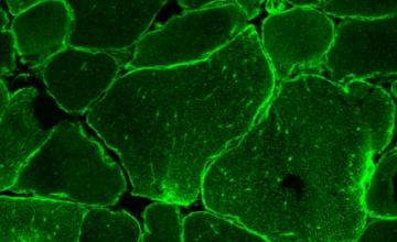 Jianming Liu (DMD/BMD): A cross-section of skeletal muscle from a research mouse engineered to express high levels of alpha-7 integrin. The distribution of the transgenic genes' products suggests only a limited amount of its binding partner beta-1 integrin in the skeletal muscle, and identified a bottle-neck factor in the development of integrin-based therapy for muscular dystrophy.