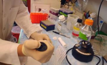 David Lynch (FA): Lynch's research team will use a process called frataxin dipstick testing in its studies to determine the relationship between abnormal resistance of the hormone insulin and Friedreich's ataxia.