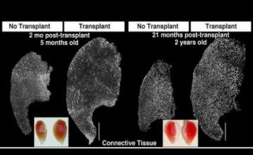 Bradley Olwin (DMD): Depicted a mouse muscle that was transplanted and examined after two months, and one that was transplanted and examined after two years. The transplanted muscles and the non-transplanted muscles in the other legs are both shown. The muscle size dramatically increases after transplantation and remains large for the lifetime of the mouse.