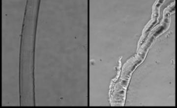 Grace Pavlath (DMD): Skeletal muscle is composed of myofibers, which are long cylindrical cells. When myofibers are injured, they can degenerate and regenerate from stem cells. However, in many neuromuscular diseases muscle, regeneration doesn't work correctly, and myofibers often adopt an abnormal structure containing numerous cellular "branches."