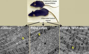 Restoring the frataxin protein to FA mice (as shown in the right panel) increases the numbers of mitochondria (M) and sarcomeres (S) in muscle. (Sarcomeres are part of muscle fiber.) An untreated FA mouse is shown in the middle, and an unaffected mouse on the left.