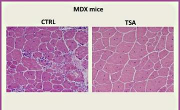 Pier Lorenzo Puri (DMD): Muscle cells from a DMD research mouse model; (left) untreated and (right) muscle treated with a histone deacetylase inhibitor called TSA.
