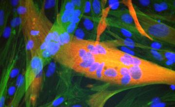 GRAF1 promotes muscle formation in a dish. Immature muscle cells fuse to form multinucleated muscle fibers during formation and repair of muscle, a process aided by GRAF1. Notice that the GRAF1 (red) expressing cell is much larger and has many more nuclei (blue) than control cells (green).