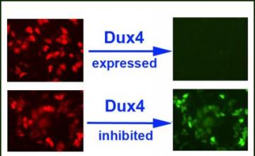 Eric Wagner (FSHD): The top panels show the amount of green fluorescence in cells when DUX4 is expressed normally, and the bottom panels demonstrate how the reporter will express green fluorescence when DUX4 expression is inhibited.