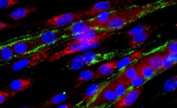 Xiaohua Wu (MD): A snapshot of the genesis of muscle cells in the laboratory. Immature muscle cells called myoblasts (red) fuse together to become myotubes with multiple nuclei (blue). Laminins, which play an important role in cell maturation and migration and survival, are stained green.