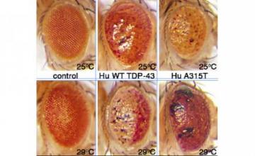 Daniela Zarnescu (ALS): A315T is a mutant form of the TDP43 protein, identified in people with ALS. Zarnescu's team has engineered a fruit fly model, containing both fly and human proteins, with the A315T mutation. Here, the eyes of adult fruit flies demonstrate the effects of (center) normal and (right) toxic TDP43.