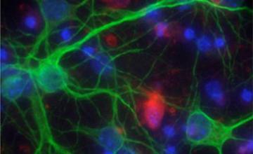 Albert La Spada (SBMD): Pictured a nerve cell, or motor neuron.