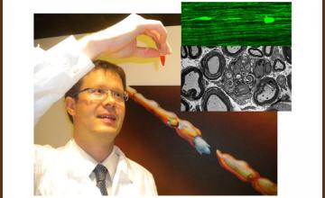 Bogdan Beirowski (CMT): Pictured behind him is a painting depicting an artistic interpretation of a degenerating axon. Inset: A view of degenerating axons from a mouse model of CMT via fluorescence (top) and electron microscopy (bottom).