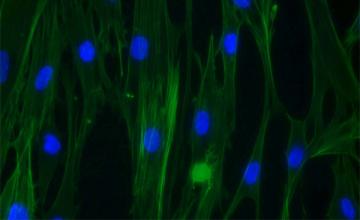 Tathagata Chaudhuri (DMD): Adult human stem cells pictured have been "grown" for five days and are on the path to becoming muscle cells. 
