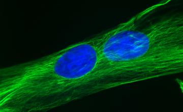 Adam Engler (DMD/BMD): This high-resolution image, taken using a microscopy technique called immunofluorescence, shows adipose-derived stem cells that have fused together to become muscle. The microtubule network is green; cell nuclei are blue.