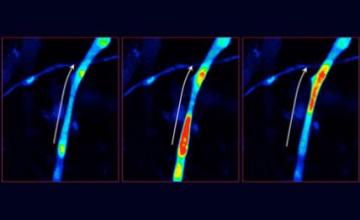 Francesco Muntoni (CCD): Time-sequence images show calcium waves in cultured immature mouse muscle fibers.